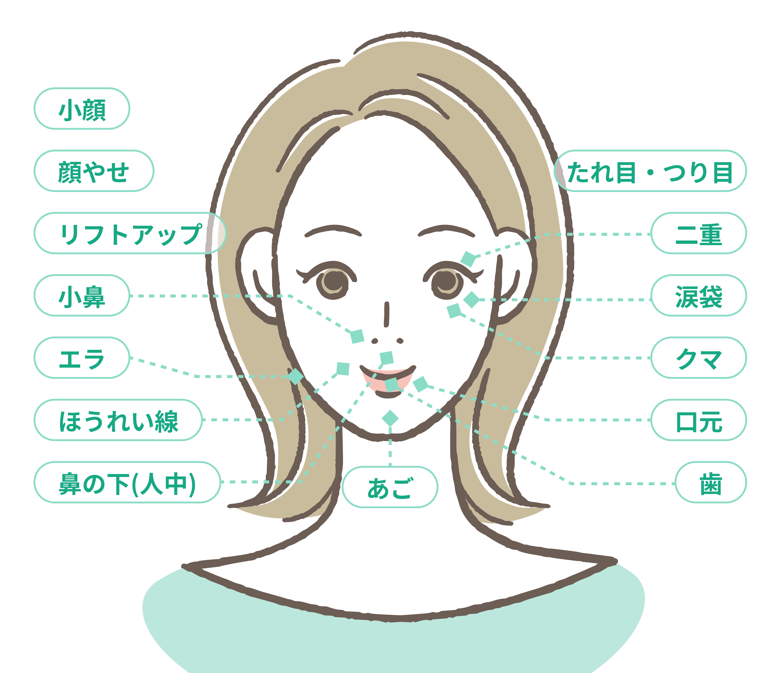 フェイスボトックスの施術部位イメージ