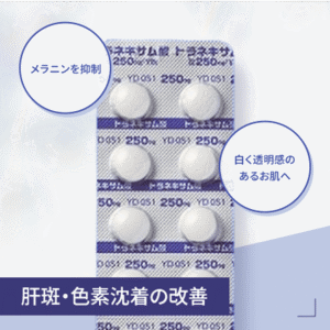 トラネキサム酸